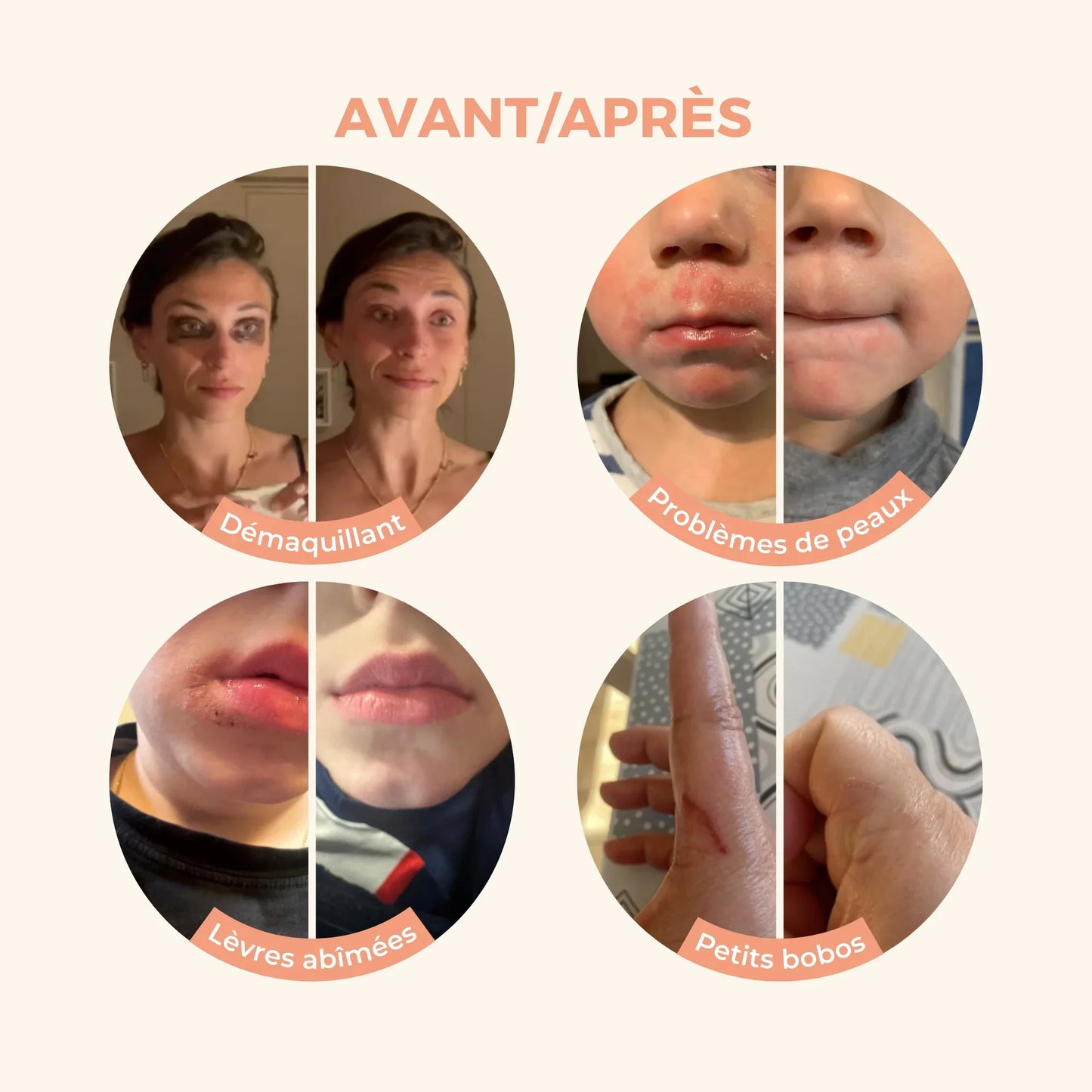 Le Baume magique en tube